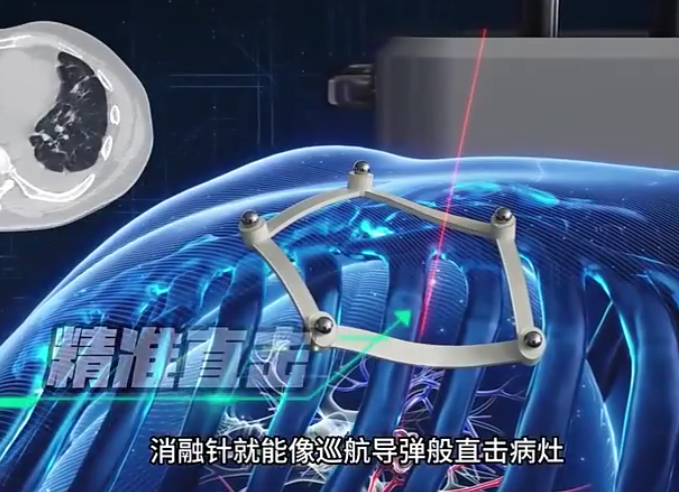 透视人体的黑技术