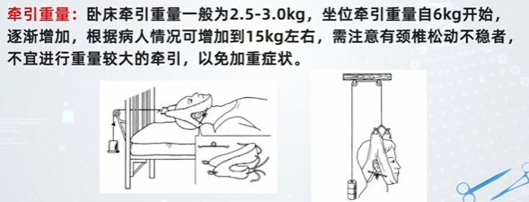 皮牵引技术