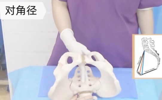 骨盆测量操作
